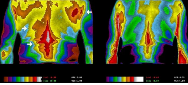 Thermal imaging showing inflammation reduction before and after grounding