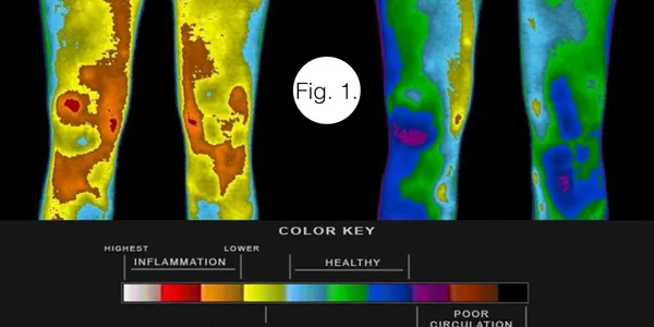Thermal imaging of knee pain before and after grounding