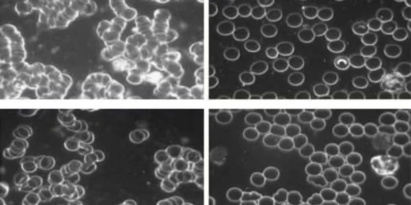 Blood viscosity comparison before and after grounding